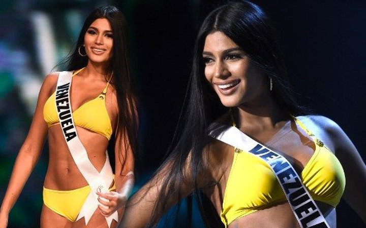 Venezuella Güzeli'nin eski hali görenleri şaşırttı