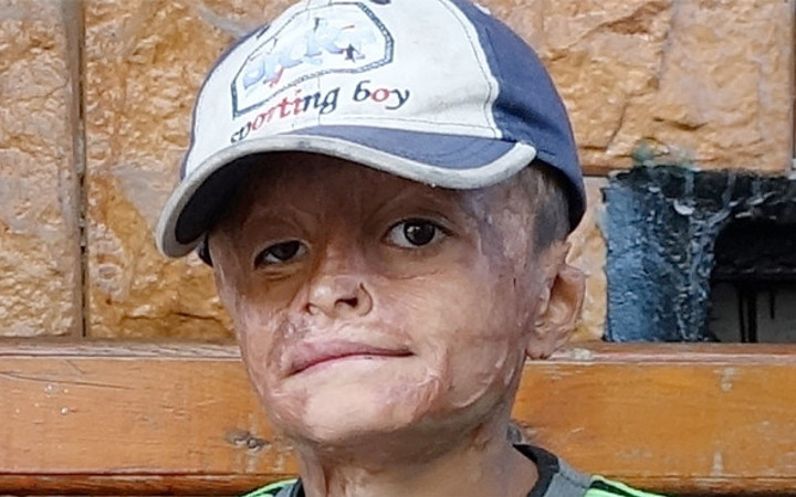 'Yeğenini dilendiriyor' denilmişti gerçek bambaşka çıktı