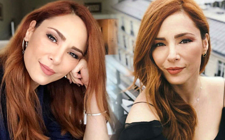 Herkes onu doğal güzel sanıyordu! Meğer Mine Tugay da estetik harikasıymış