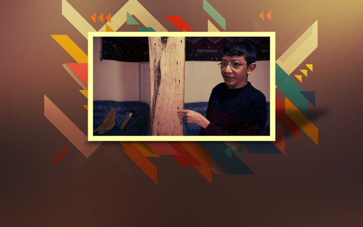 Kayseri'de yaşını duyan inanamıyor! 'Benjamin Button' vakası