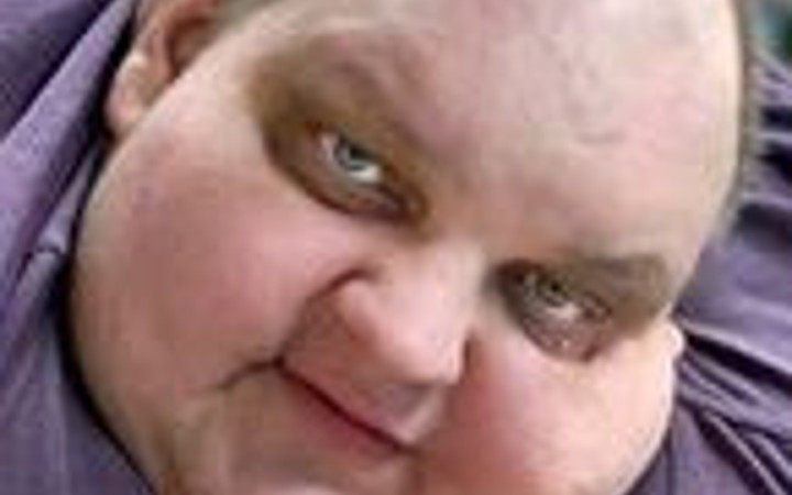 Kilolu erkekler dikkat!