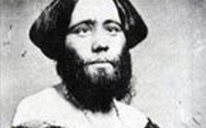 Onlar dünyanın en sakallı kadınları!