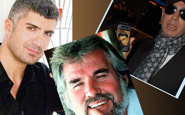 İşte estetik yaptıran ünlü erkekler!