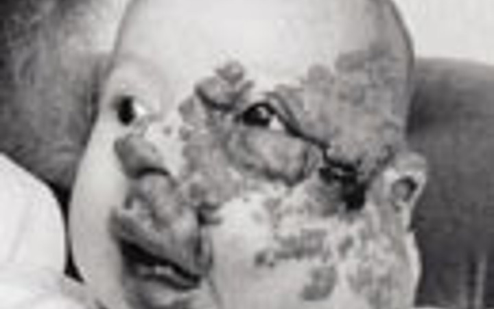 Mucize gibi bir şey!