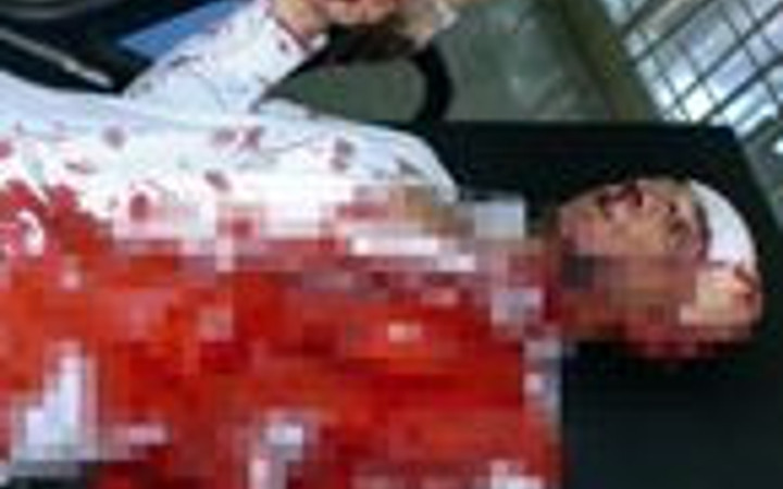 Yan bakma tartışmasına kan bulaştı