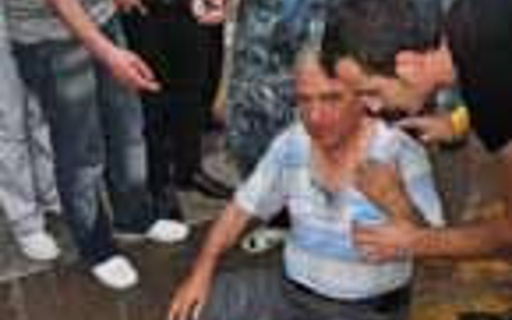 Mısır alırken kıyafetleri alev aldı