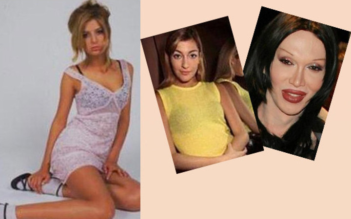 Bu ünlüler tam bir estetik bağımlısı 