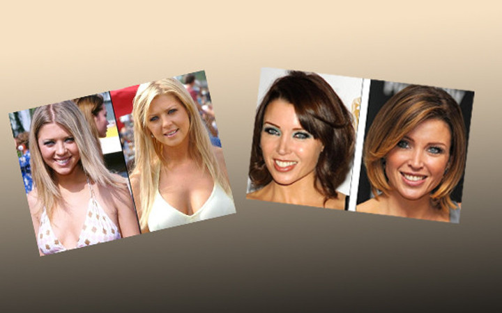 Estetikle güzelleşeyim derken...