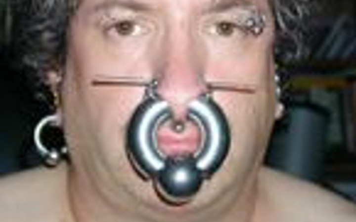 Onların her yeri delik deşik