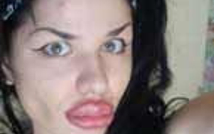 Onun yeni hali görenleri dehşete düşürüyor