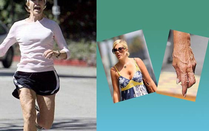 Ünlülerin defolu halleri