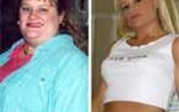 Değişimleri ile görenleri şok ettiler