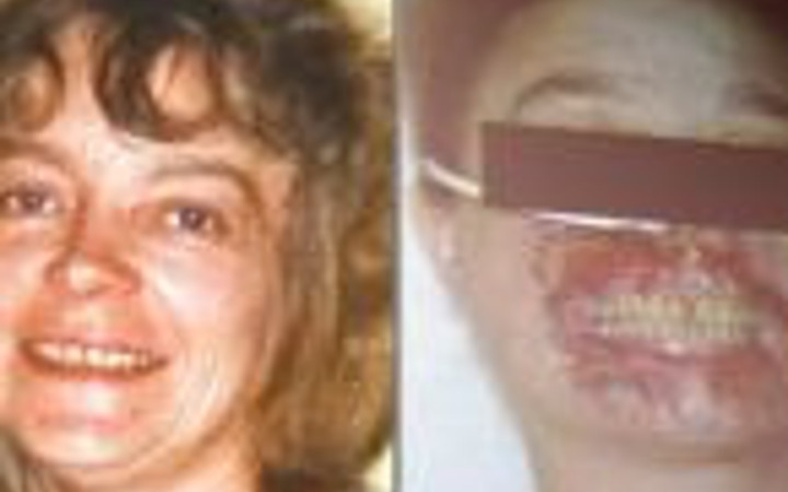 İşte dünyanın diğer nakil yüzleri