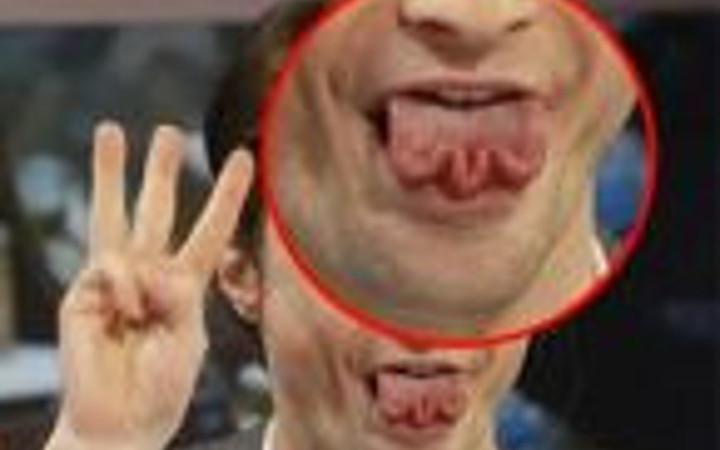 Harry Potter'ın tuhaf yeteneği