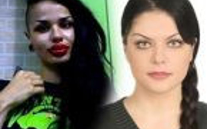 Bir estetik faciası daha