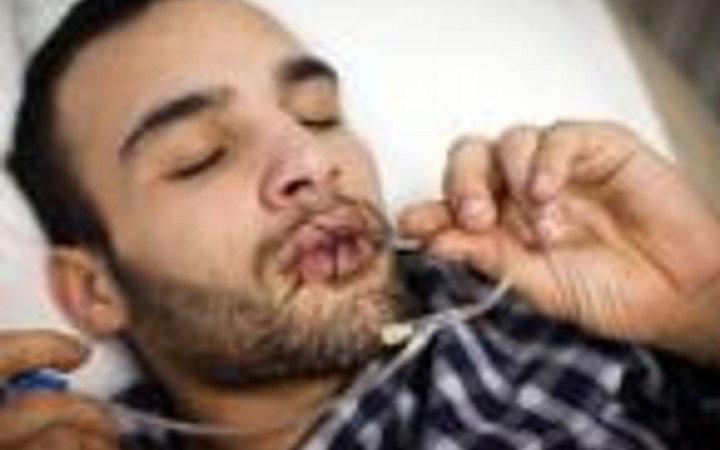 Kendi ağzını böyle dikti!