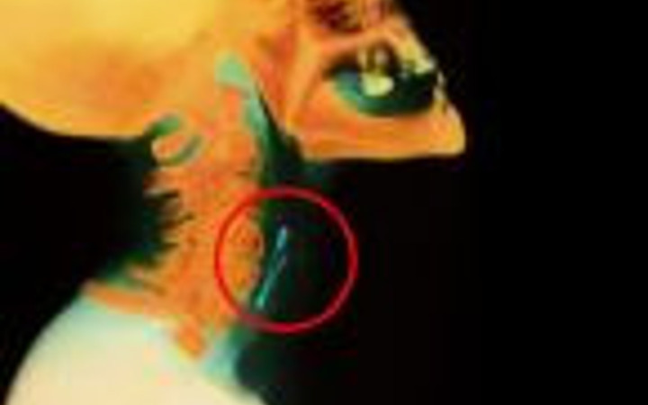 Dünyanın en ilginç röntgenleri!