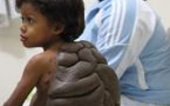 Kaplumbağa çocuk görenleri şok etti