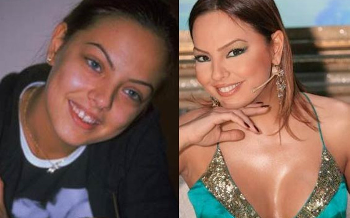 Ünlülerin eski dişlerine bakın!