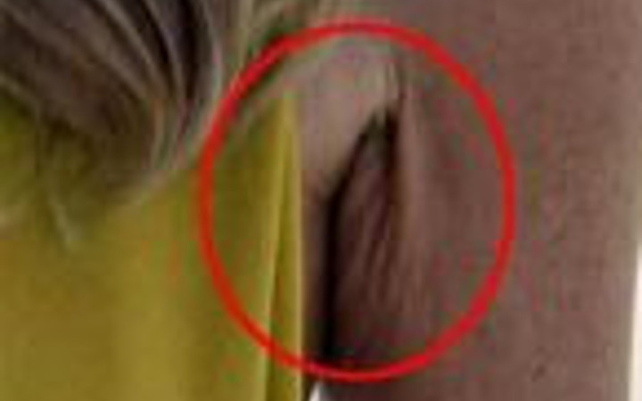 Ünlülerin yakından hali korkunç