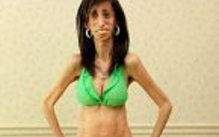 25 kiloluk kız dehşete düşürdü