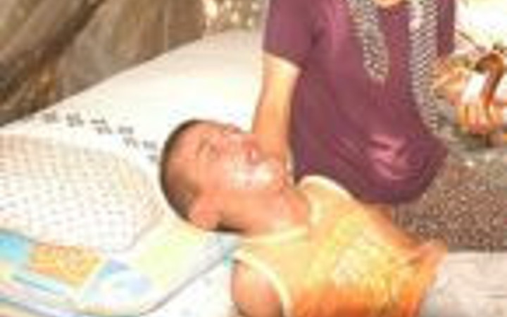 Bu çocuk 8 yıldır kaşınıyor