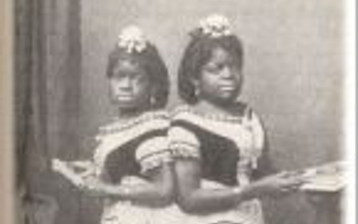 Bu ikizleri birbirinden ayırmak mümkün değil