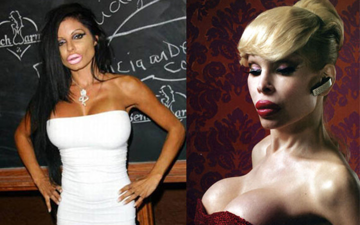 Estetik sonrası faciaya dönüştüler