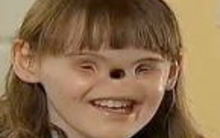 Burun ve gözü olmayan kız