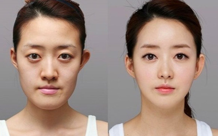 Estetikle öyle değiştiler ki!