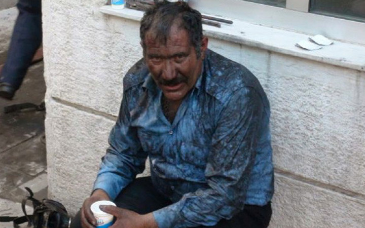 Kendini ateşin ortasına attı!