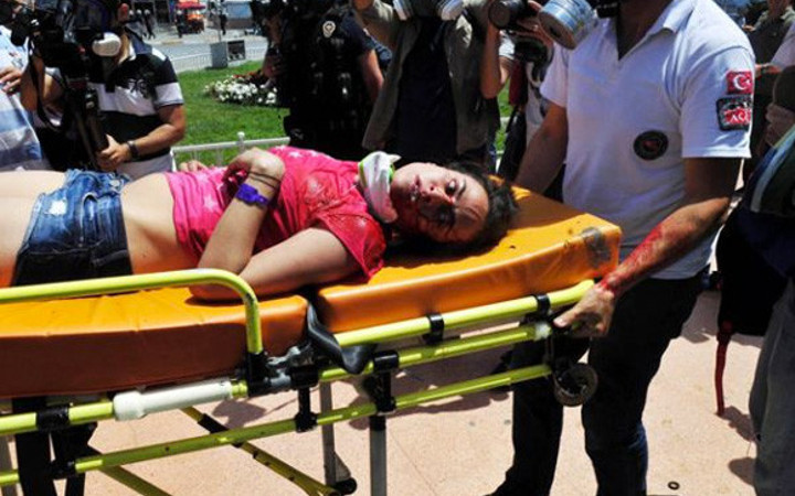 Turistin kafasını kırdılar...