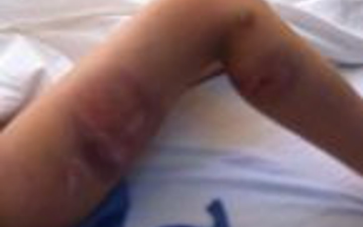 Twitter'dan dayak fotoğraflarını paylaştı