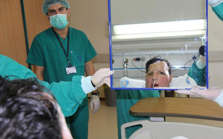 Recep Sert ilk kez yeni yüzüyle tanıştı