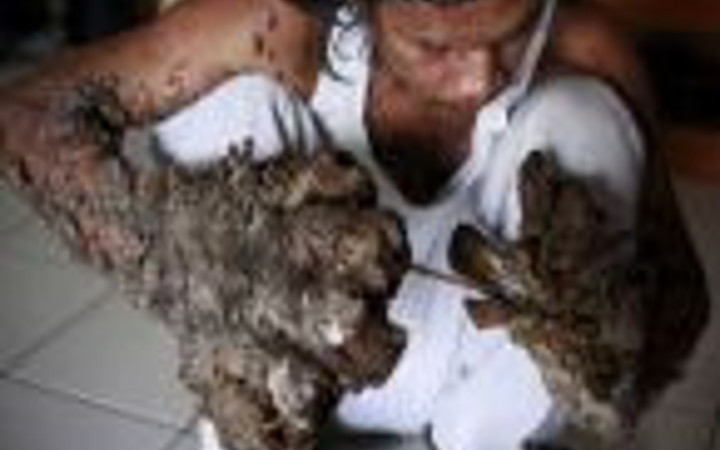 Ağaç adamın son hali