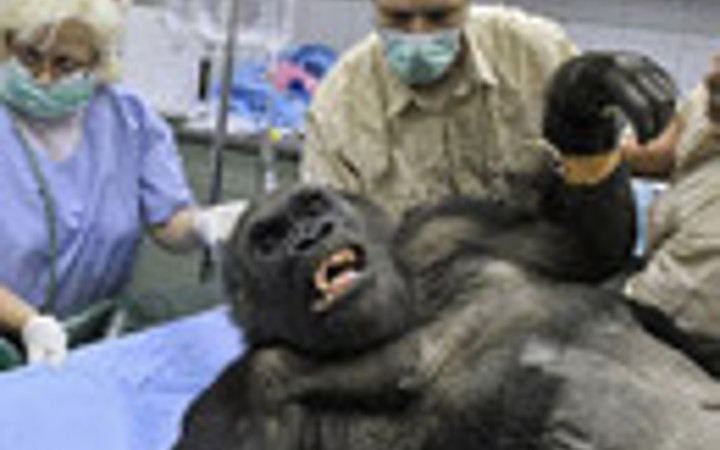 King Kong ameliyat oldu!