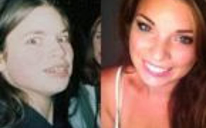 İnsan bu kadar mı değişir dedirten fotoğraflar