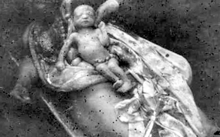 Hocalı katliamında bebeklerin gözlerini oydular