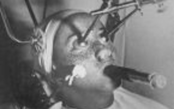 İşkence aleti değil güzellik yöntemi!