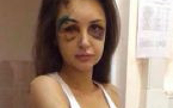 Rus milyarder sevgilisini mahvetti!