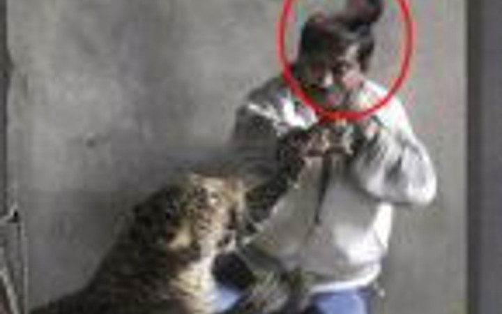 Leopar saldıran talihsiz adamın kafa derisi böyle uçtu