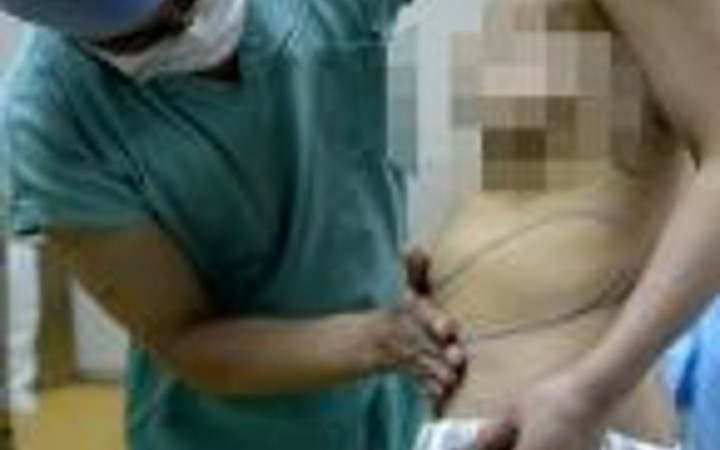 Silikonlarından birisi sırtında diğer karnında!