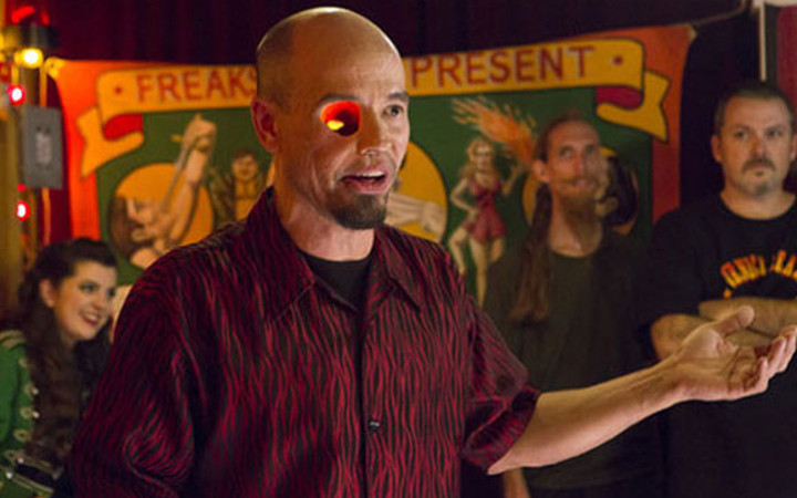 Bu adam yüzünün yarısı olmadan yaşıyor