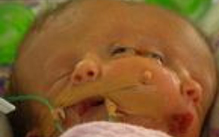 Onlar hayatta kalan tek ikizler