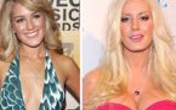 Estetik olup eski yüzlerini bile unutanlar