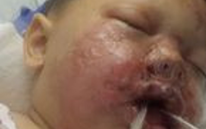 Polisin attığı ses bombası bebeği bu hale getirdi