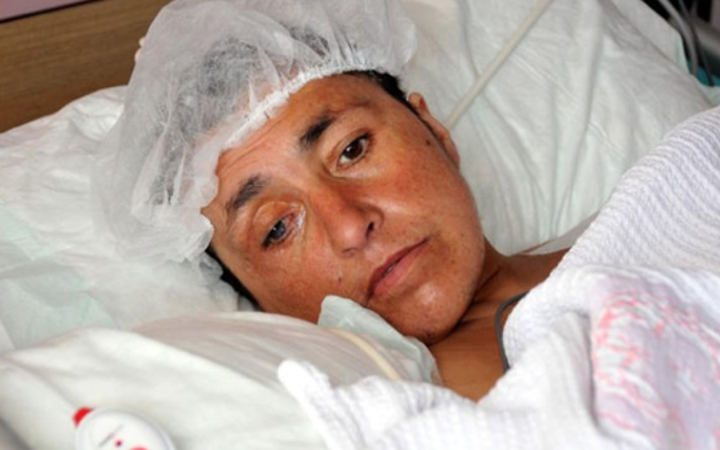 Bakımsızlıktan vücudu kurtlandı!