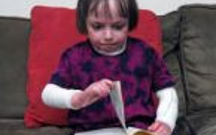 Bu kızın hastalığı içinizi acıtacak