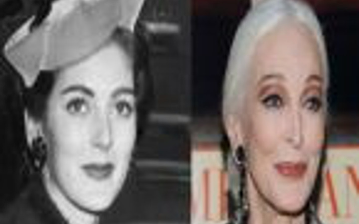 Efsane güzellerin önceki ve sonraki halleri