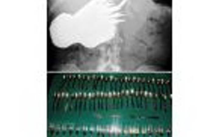 Midesinden öyle şeyler çıktı ki...